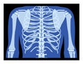X-Ray rib cage and hands Skeleton Human body Bones adult people roentgen back view. 3D realistic flat blue color concept