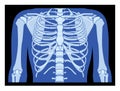 X-Ray rib cage and hands Skeleton Human body Bones adult people roentgen front view 3D realistic flat blue color concept