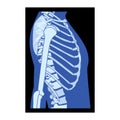 X-Ray rib cage and hands Skeleton Human body Bones adult people roentgen side view. 3D realistic flat blue color concept