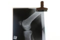 X-ray of right patella knee joint Royalty Free Stock Photo