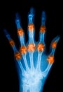 X-Ray scan human for hand Royalty Free Stock Photo