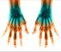 X-Ray scan human for hand