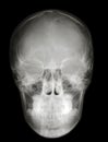 X-ray scull front profile Royalty Free Stock Photo