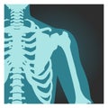 X-ray shot of shoulder, human body bones, radiography, rib cage, chest and arm, vector illustration. Royalty Free Stock Photo