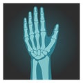 X-ray shot of wrist, human body, bones of hand, radiography, vector illustration. Royalty Free Stock Photo