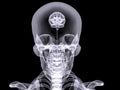 X-ray small brain Royalty Free Stock Photo