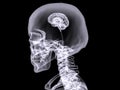 X-ray small brain Royalty Free Stock Photo