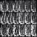 X ray of spine