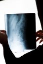 X-ray of the spine in the hands of a man Royalty Free Stock Photo