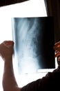 X-ray of the spine in the hands of a man Royalty Free Stock Photo