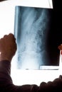 X-ray of the spine in the hands of a man Royalty Free Stock Photo