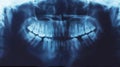 X-ray of teeth, stomatology Royalty Free Stock Photo