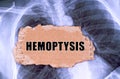 On the X-ray there is a piece of cardboard with the inscription - hemoptysis Royalty Free Stock Photo