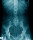 X-ray thoraco-lumbar human structure with pelvic bone Royalty Free Stock Photo