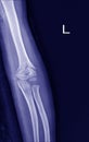 X-ray view of elbow on a black background Royalty Free Stock Photo