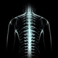 A X-ray view of a human torso highlighting the spinal column and rib cage. portrays a clinical and anatomical study