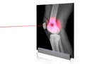 X-rays-6 Royalty Free Stock Photo