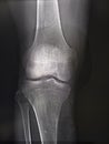 X-rays of the knee joint close up