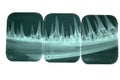 X-Rays of Sharp Teeth