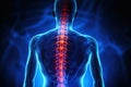 x-rays of the spine, Scoliosis film x-ray show spinal bend in teenager patient