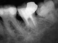 X-rays of teeth macro