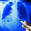 Xray ct chest film syringe Royalty Free Stock Photo