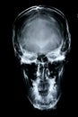 Xray/Face front Royalty Free Stock Photo