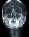 Xray/Face front Royalty Free Stock Photo