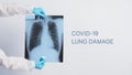 Xray film of Covid 19 lung damage and holding by doctor hand in medical glove and PPE