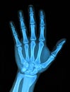 Xray hand Royalty Free Stock Photo