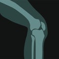 Xray of knee joint, roentgen scan of human body