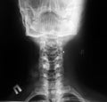 Xray neck Column and Head Royalty Free Stock Photo