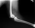 Xray repair of fractured femur in a dog