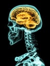 Xray of skull with brain. Royalty Free Stock Photo