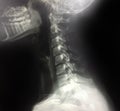 Xray Spinal Column and Skull Head