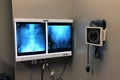 Medical XRays In A Doctors Office.