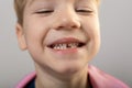 5 year old boy shows first fallen milk tooth. smiling five-year-old boy without one tooth Royalty Free Stock Photo