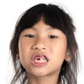 6 years old child has lost the baby tooth.