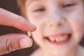 At 6 years old child has lost the baby tooth. The girl is holding the tooth in his hand Royalty Free Stock Photo