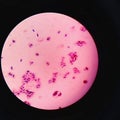 yeast cells in gram stain fine with microscope.