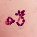 yeast cells in gram stain fine with microscope.