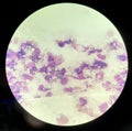 Yeast cells phagocytosis by white blood cell in blood smear