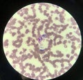 Yeast cells phagocytosis by white blood cell in blood smear