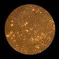 Yeast growth under a microscope