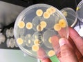Microorganisms were grown in a plate of agar medium.
