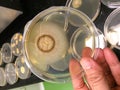 Microorganisms were grown in a plate of agar medium.