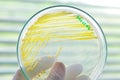 Yellow colony in petridish Royalty Free Stock Photo