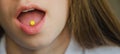 the yellow pill lies on the woman's red tongue. mouth close-up. disease and treatment concept. skin