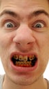Yellow teeth Royalty Free Stock Photo