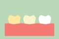 Yellow to white tooth, teeth whitening concept